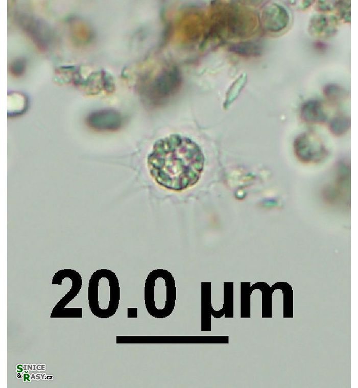 Echinosphaerella limnetica