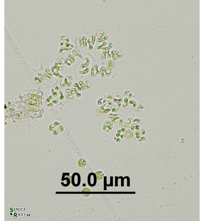 Kirchneriella contorta