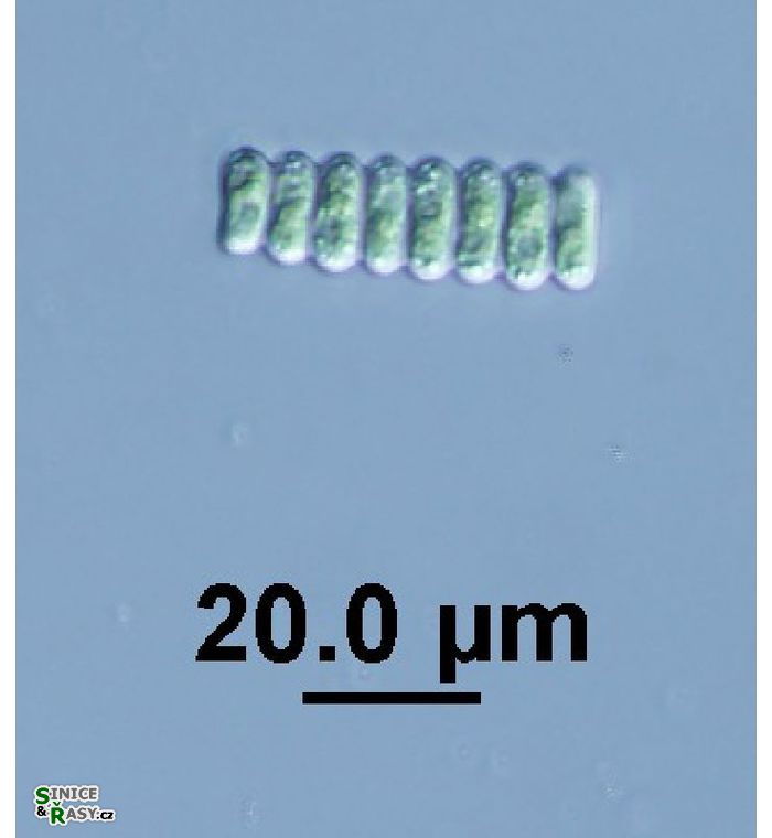 Scenedesmus ellipticus