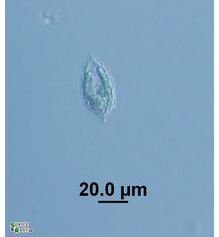 Mallomonas sp. 