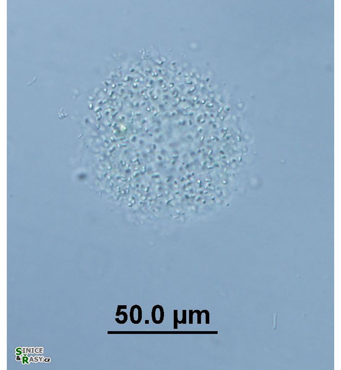 Aphanocapsa