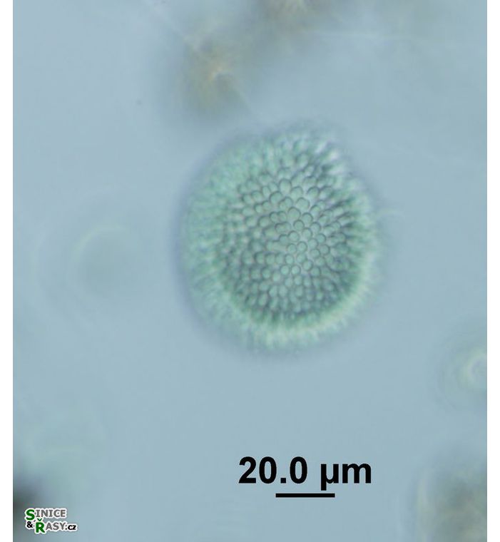 Woronichinia karelica