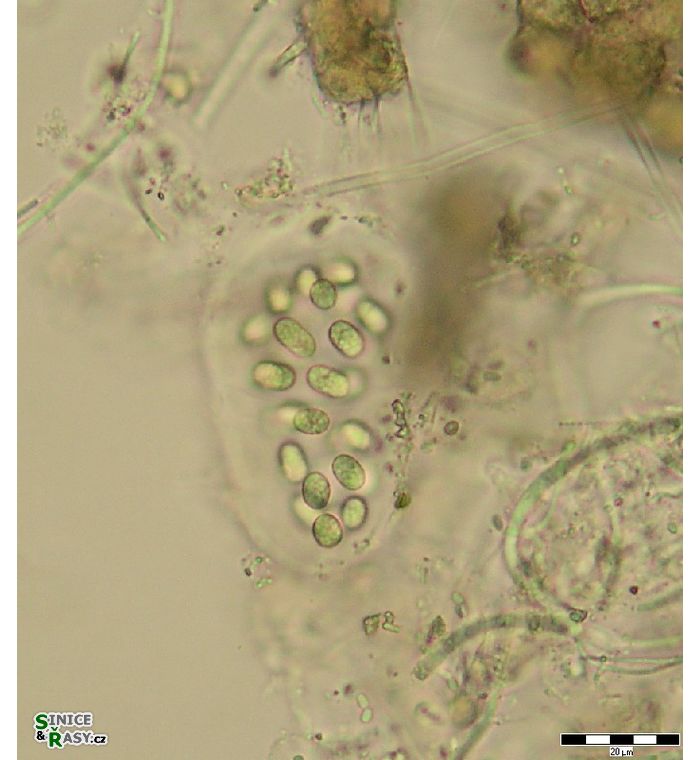 Aphanothece variabilis