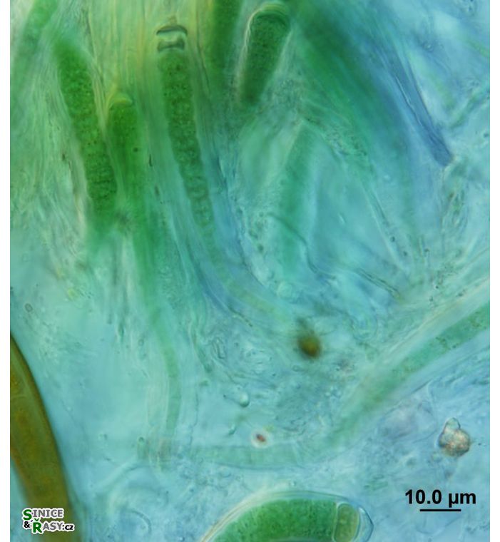 Calothrix contrarenii