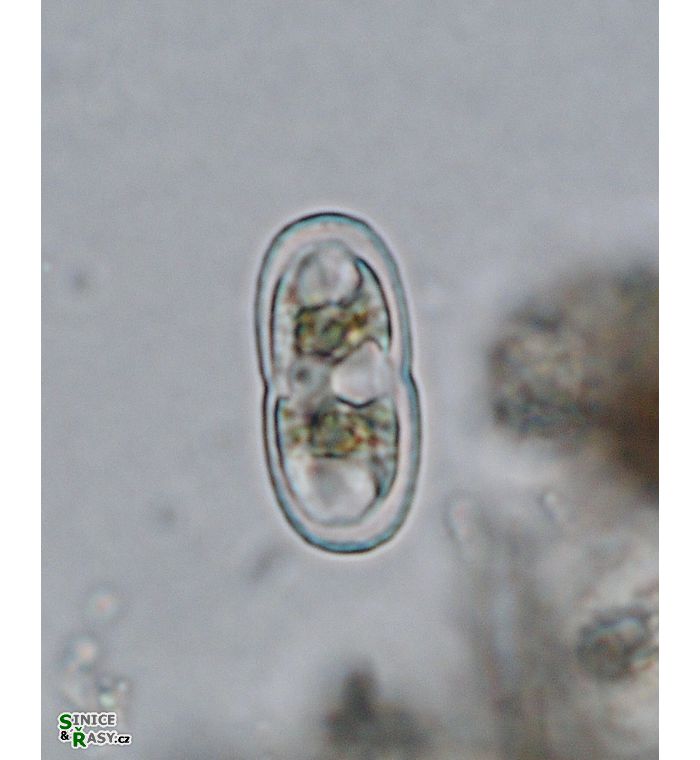 Actinotaenium kriegeri