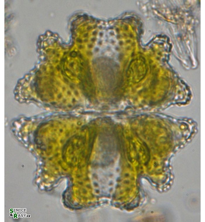 Euastrum verrucosum