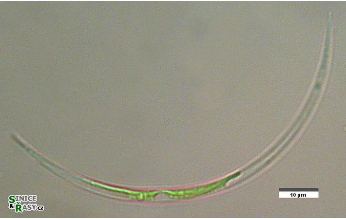 Closterium acutum
