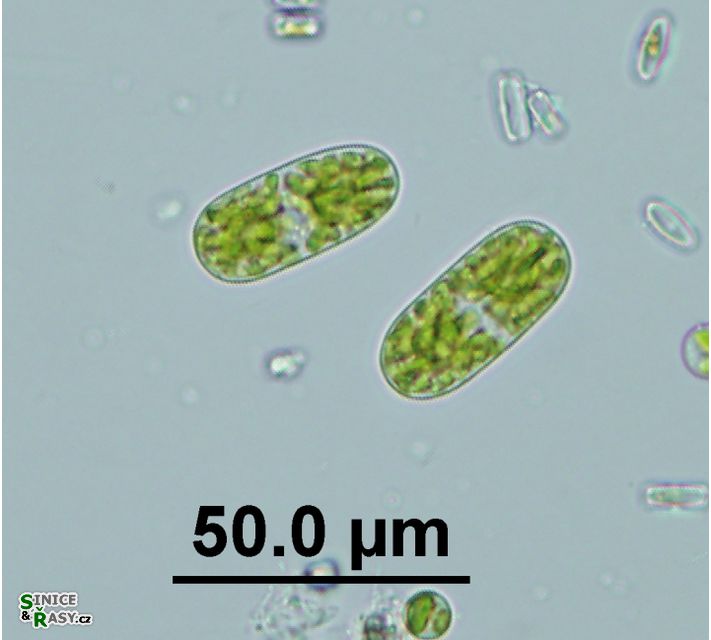 Cylindrocystis brebissonii
