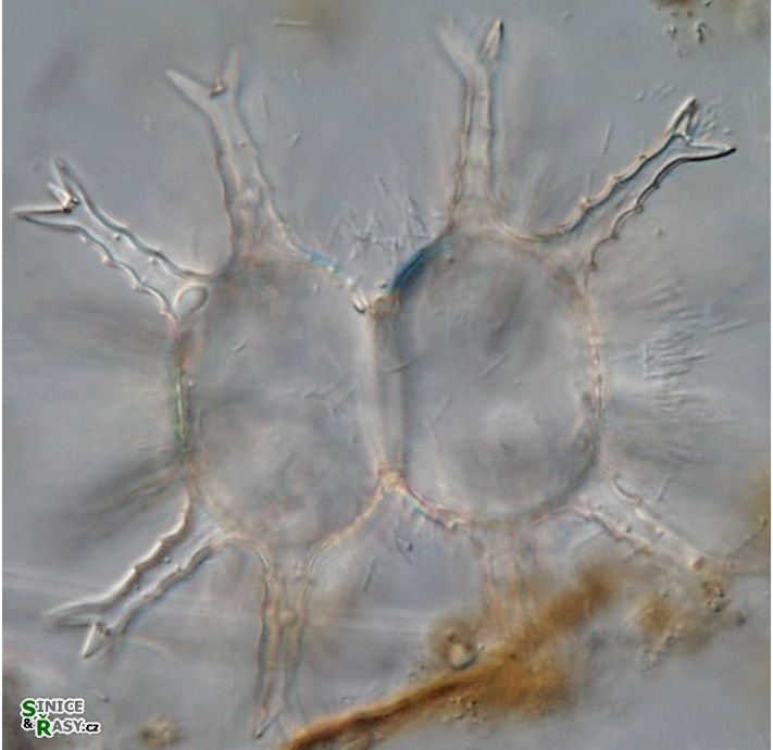Staurastrum arctiscon