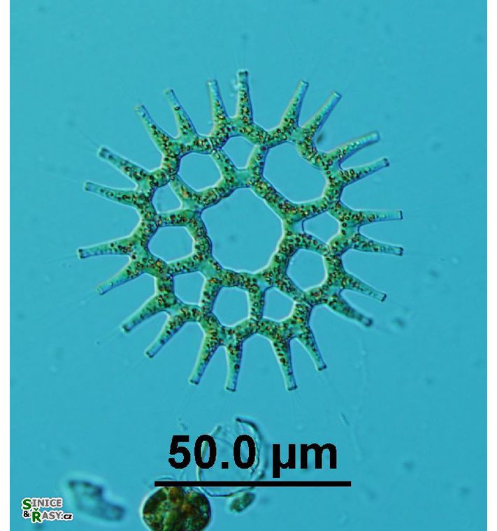 Lacunastrum gracillimum