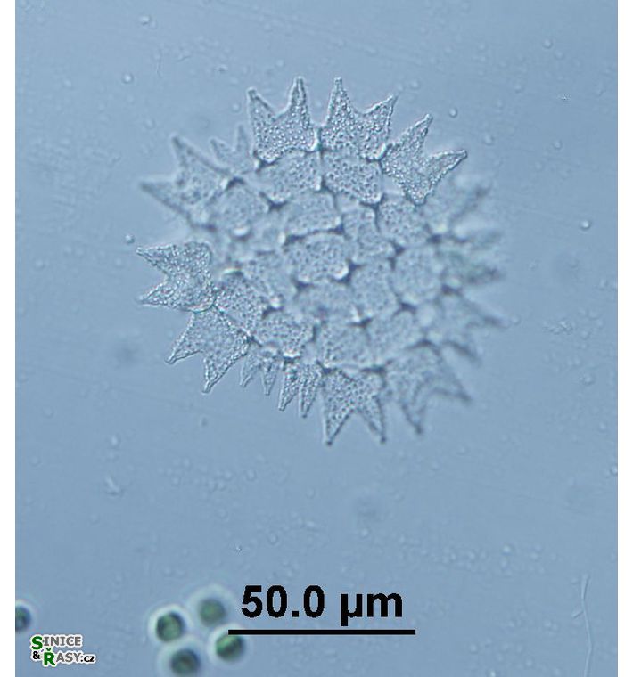Pediastrum duplex var. subgranulatum