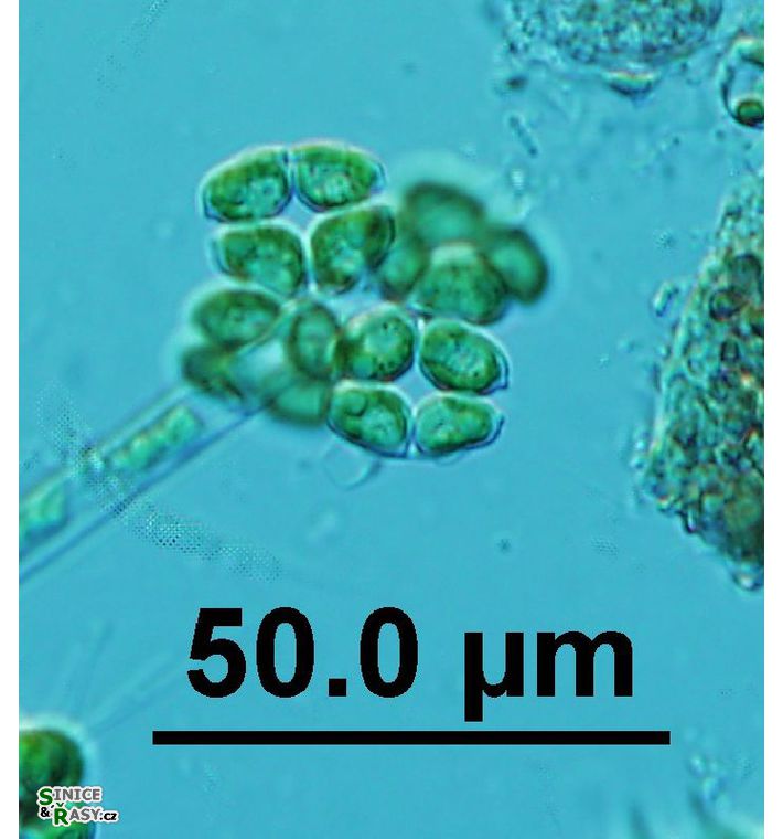 Crucigeniella apiculata