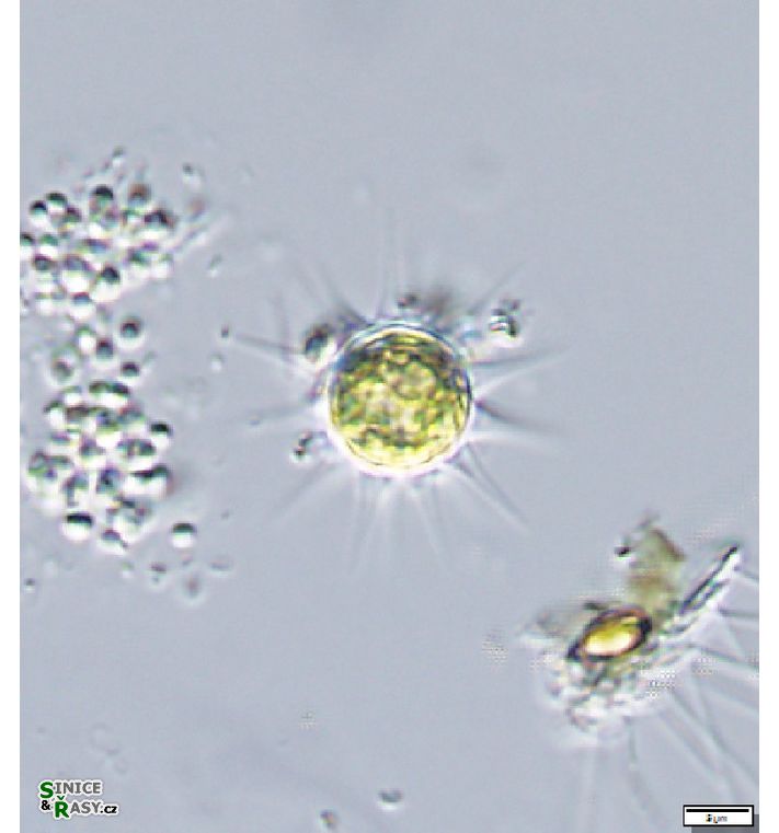 Glochiococcus aciculiferus