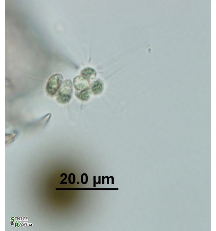 Micractinium pusillum