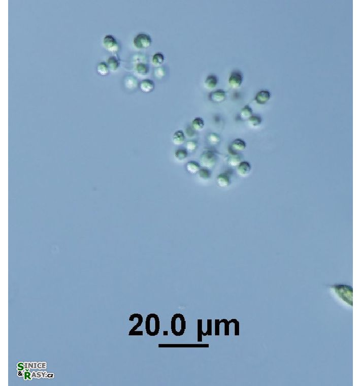 Mucidosphaerium pulchellum