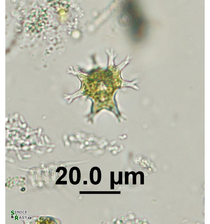 Pseudostaurastrum enorme