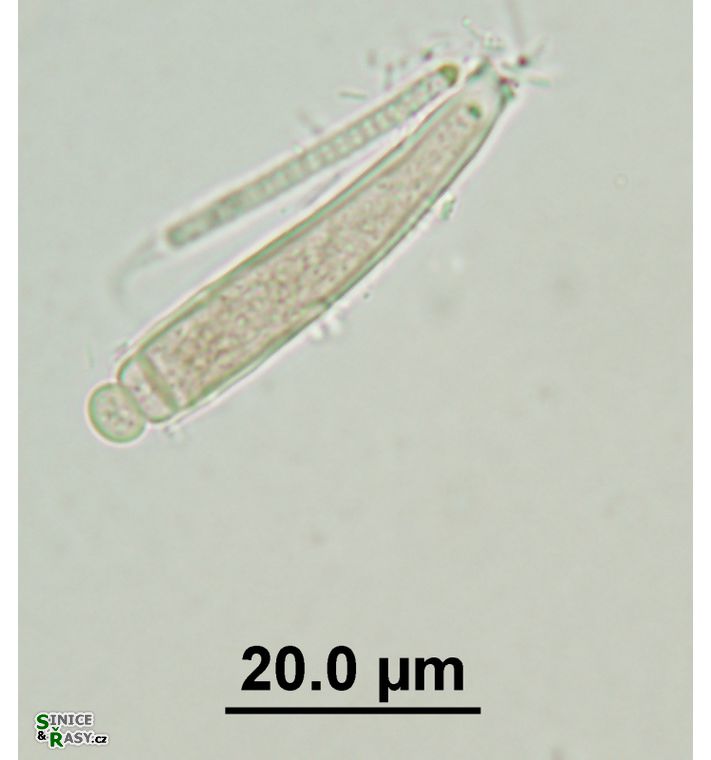 Chamaesiphon cenfervicola