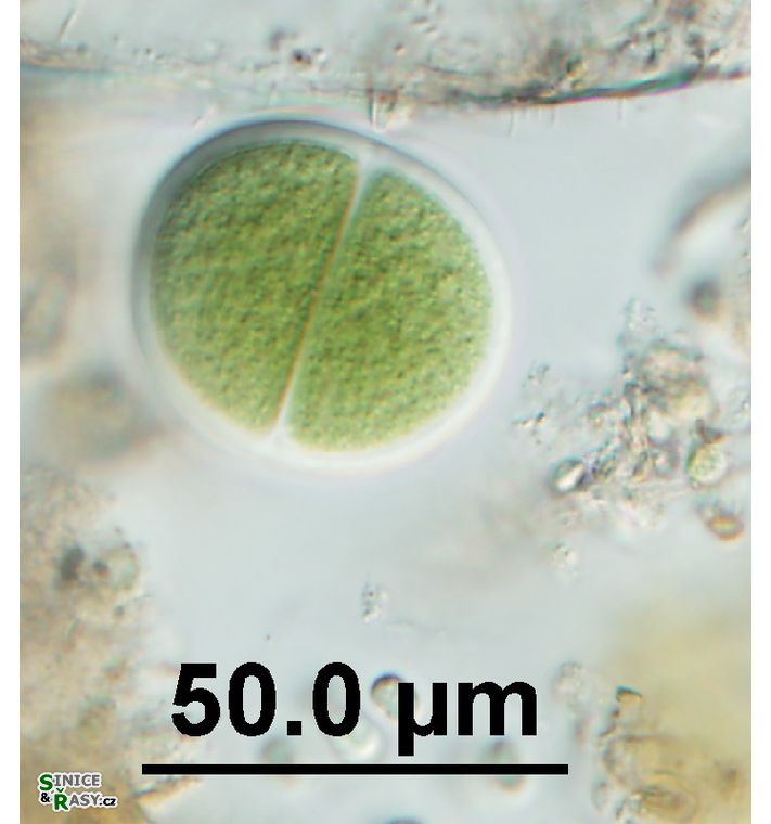 Chroococcus turgidus