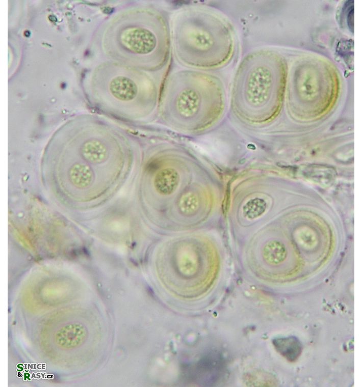 Gloeocapsa rupestris