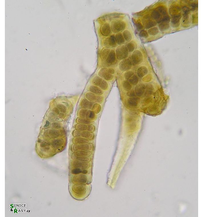 Stigonema