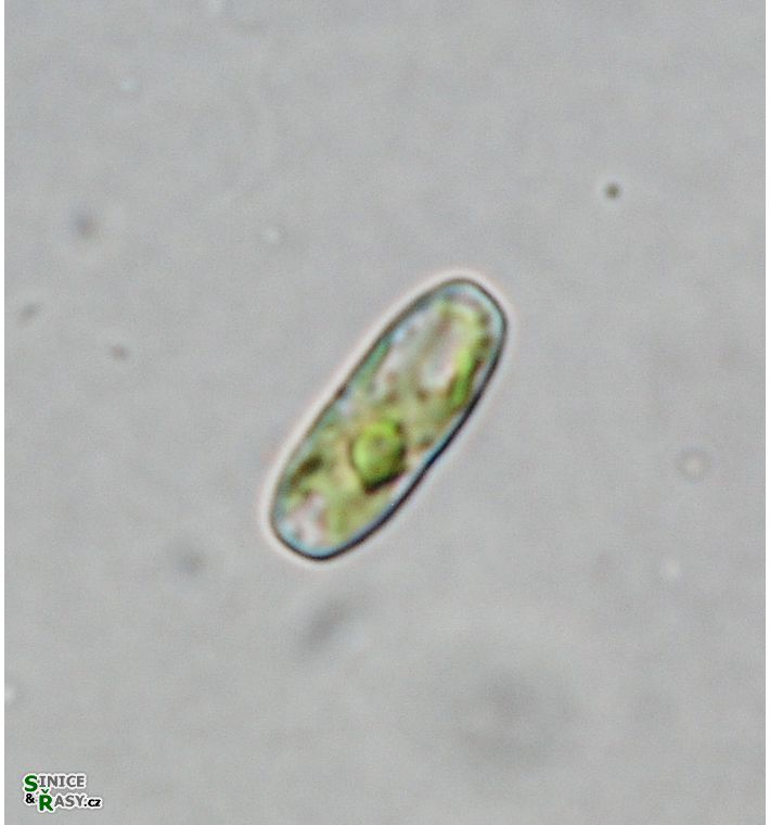 Actinotaenium inconspicuum