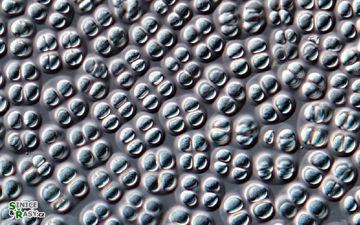 Chroococcus