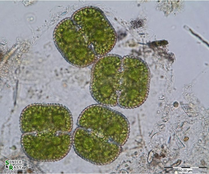 Cosmarium quadrum