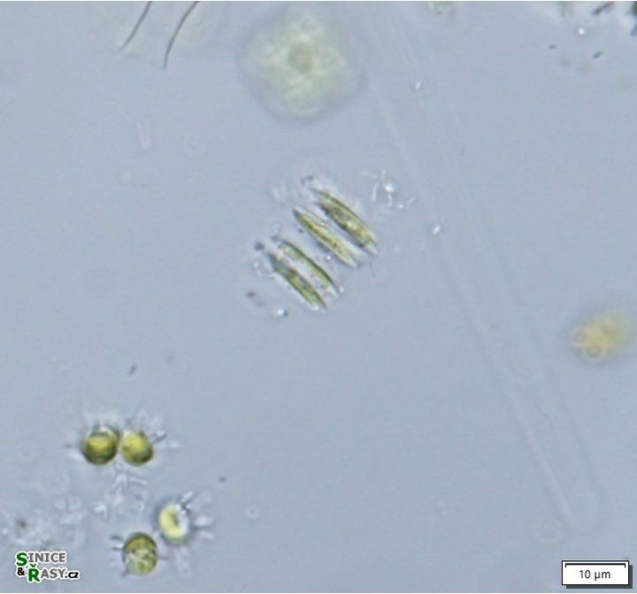 Quadrigula closterioides