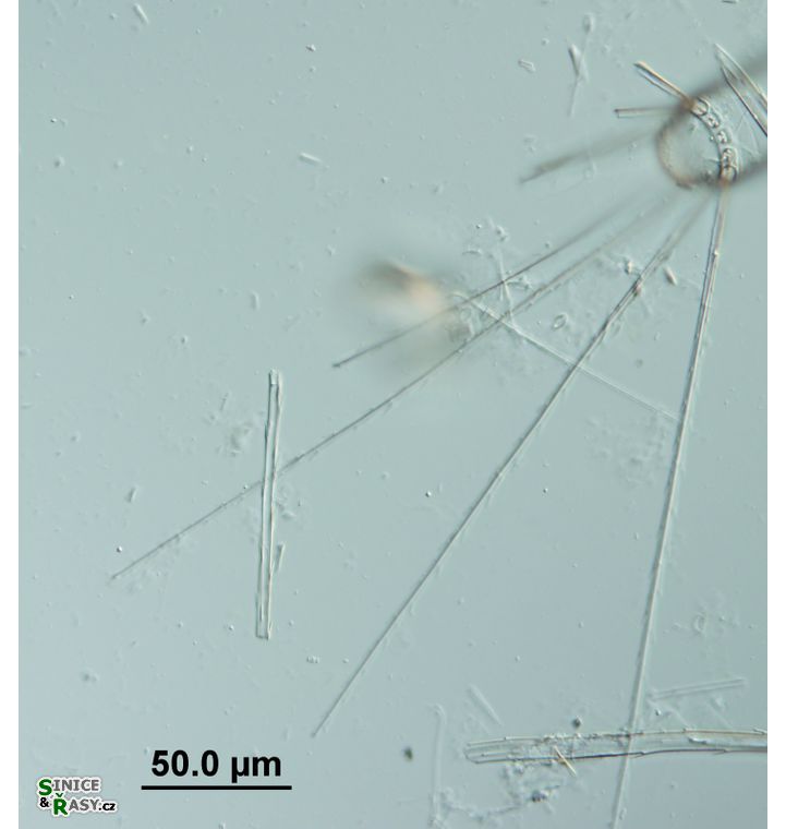 Corethron hystrix