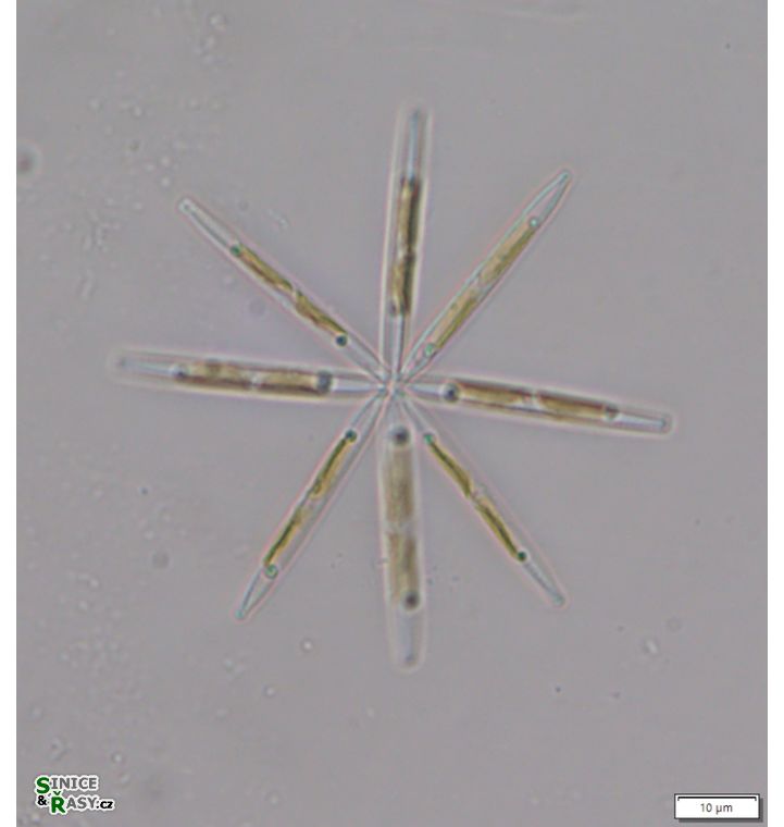 Nitzschia paleacea