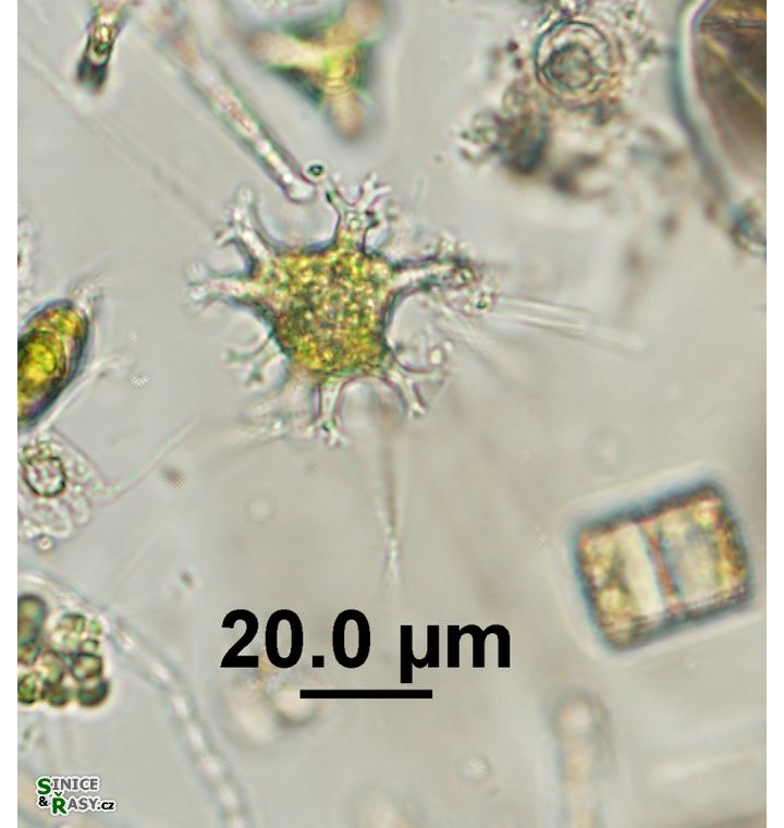 Pseudostaurastrum enorme