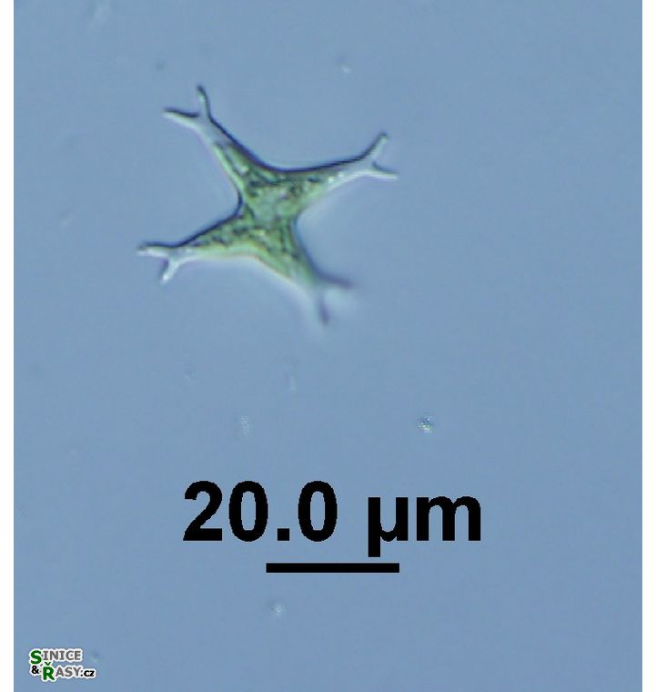 Pseudostaurastrum limneticum