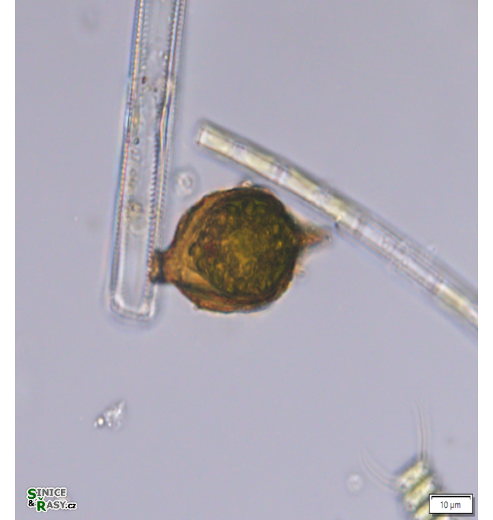 Strombomonas acuminata