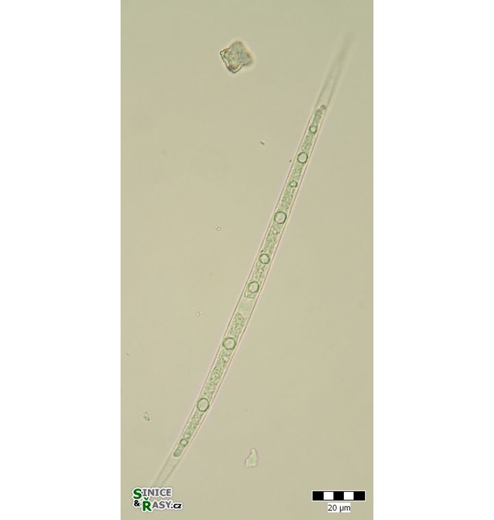 Closterium limneticum