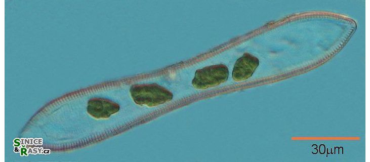 Cymatopleura solea