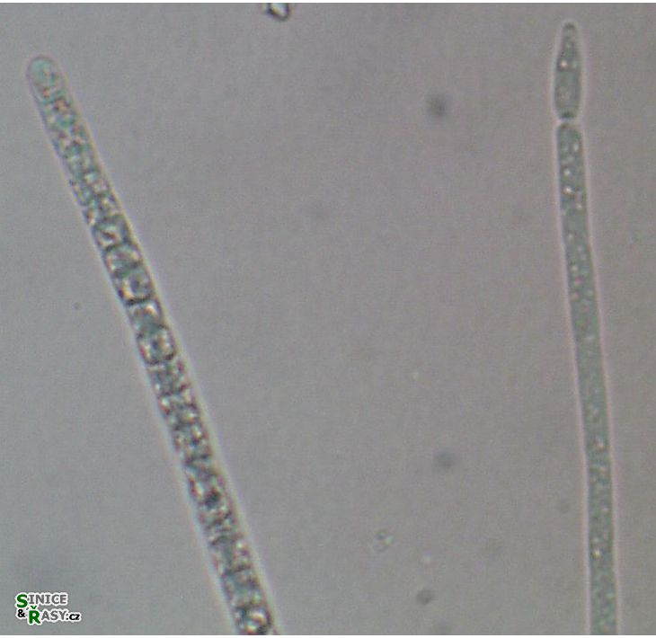 Cylindrospermopsis raciborskii