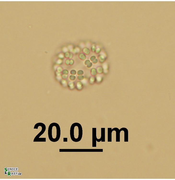 Snowella litoralis