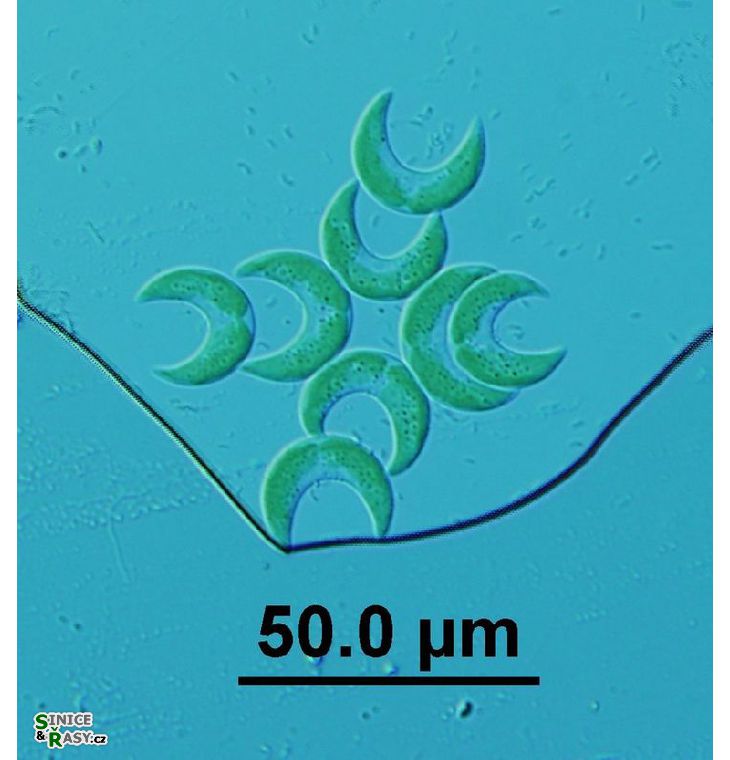 Selenastrum bibraianum