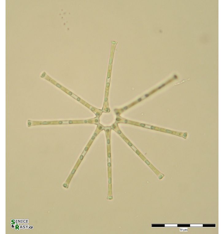 Asterionella formosa