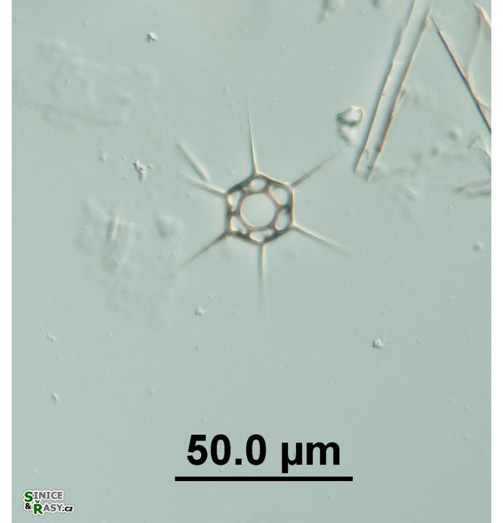 Dictyocha speculum