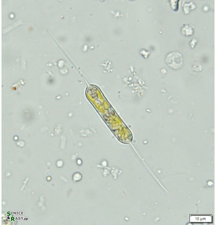 Centritractus