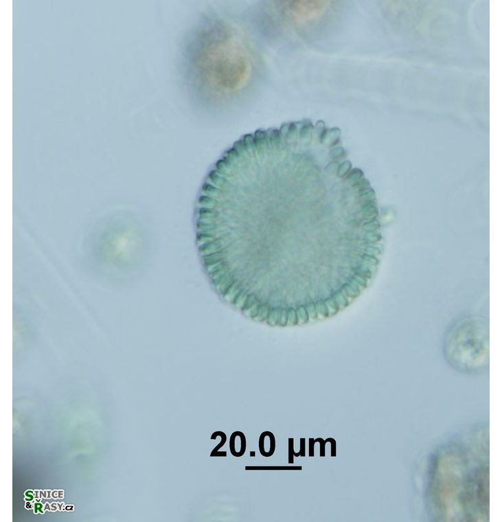 Woronichinia karelica