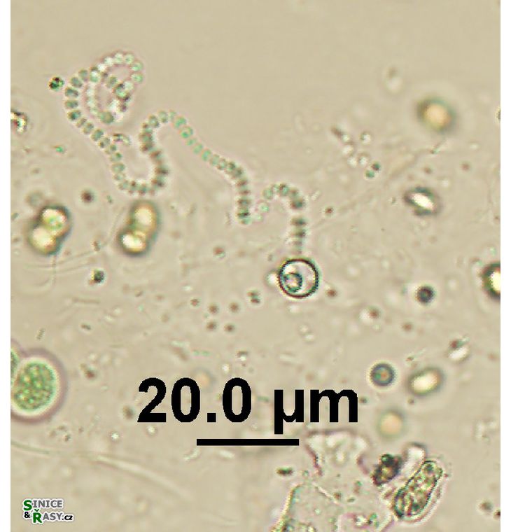 Komvophoron sp.