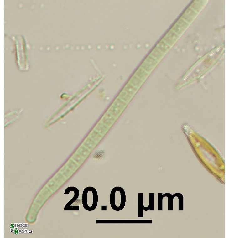 Phormidium autumnale