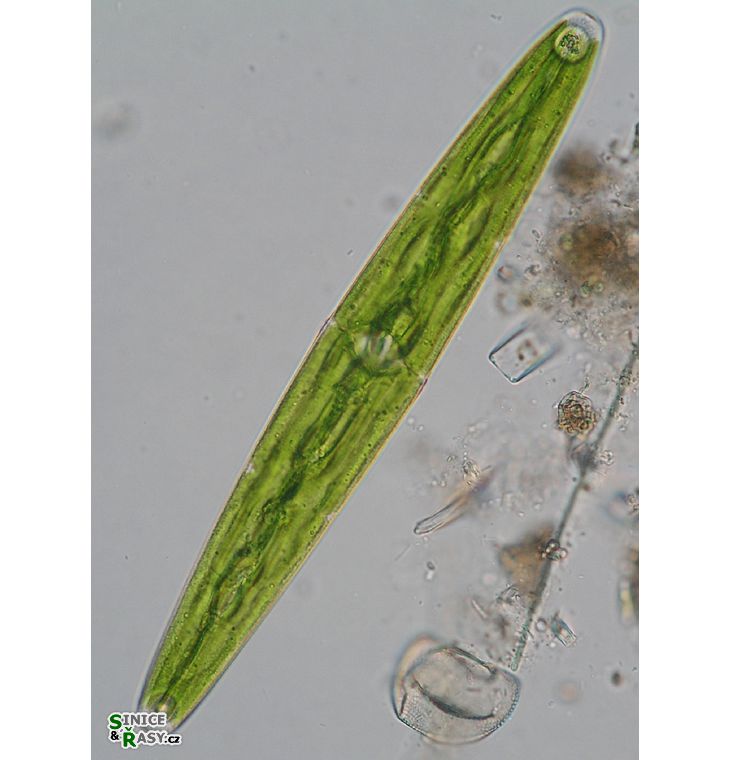 Closterium closterioides