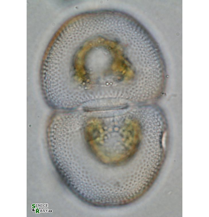 Cosmarium incrassatum