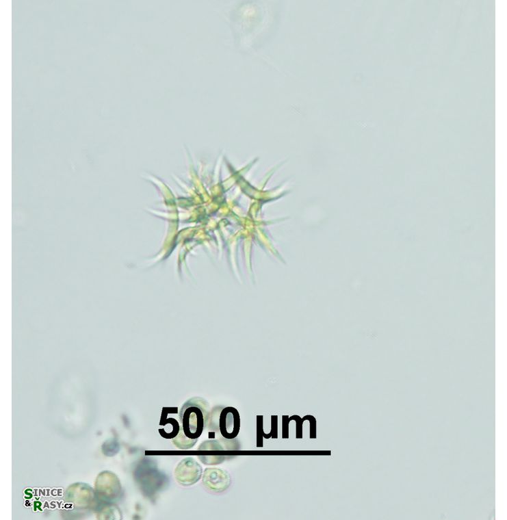 Ankistrodesmus gracilis