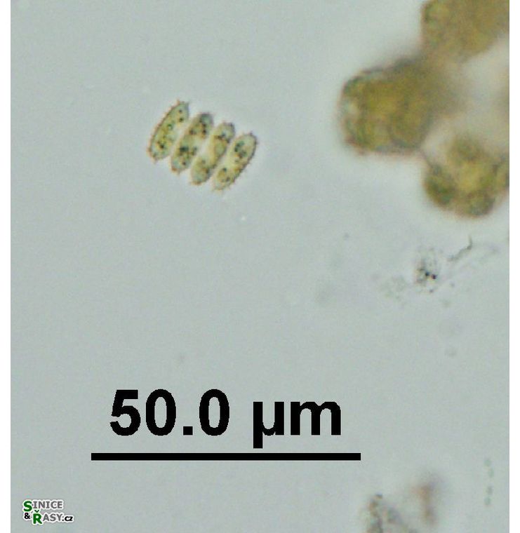 Desmodesmus serratus