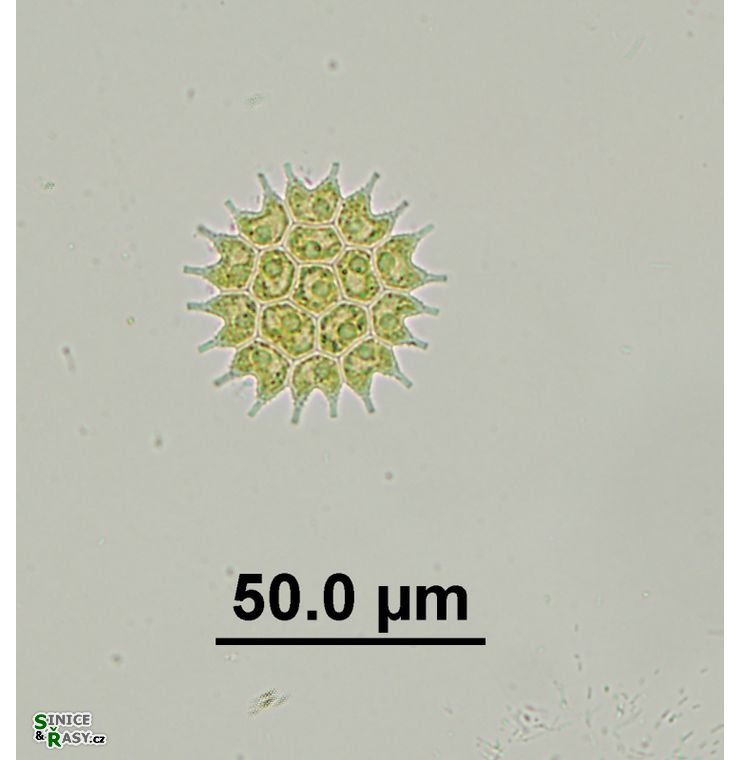 Pseudopediastrum boryanum