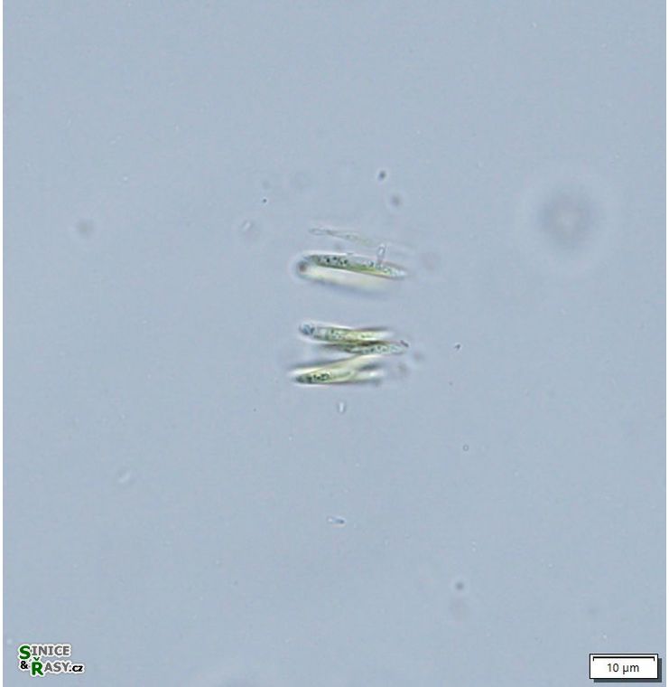 Quadrigula closterioides